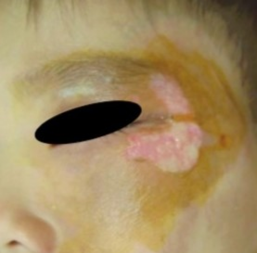 Before/After Image